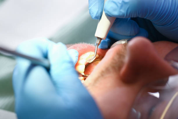 Professional Emergency Dental Service in MN
